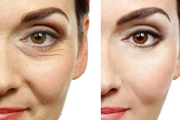 هایفوتراپی چیست و چرا انتخاب بهترین مرکز هایفوتراپی در هروی اهمیت دارد؟